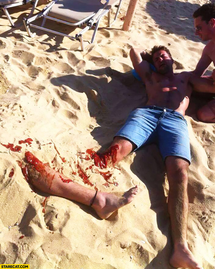 Creative vacation photo – man lost his leg beach ketchup