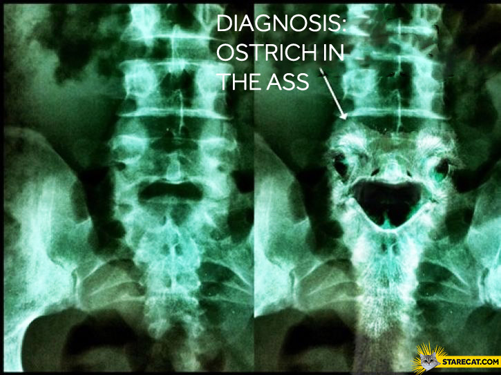 Diagnosis: ostrich in the ass