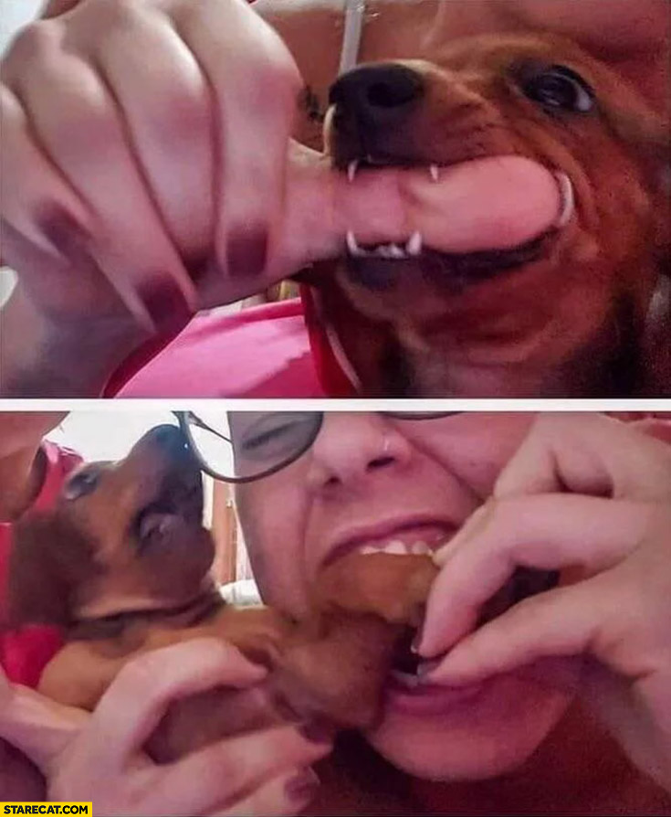Dog biting human finger, girl bites back