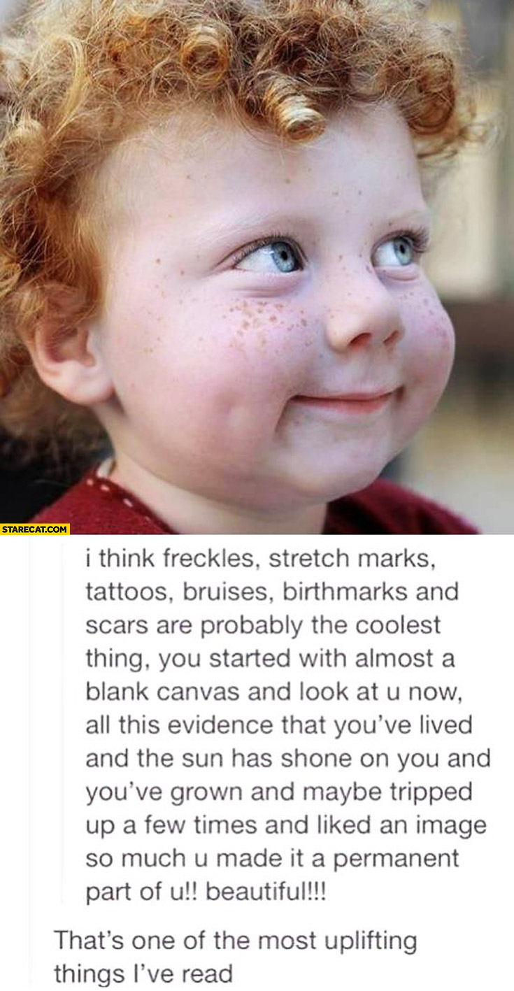 Freckles strech marks tattoos bruises are cool you started as a blank canvas now it’s permanent part of you