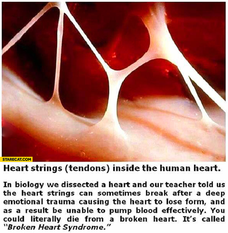 Heart strings tendons broken heart syndrome