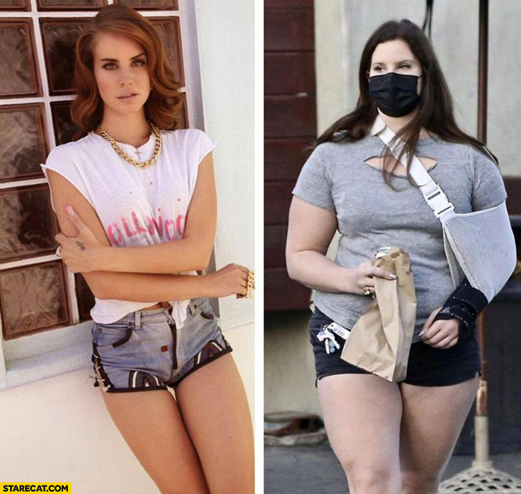 Lana Del Rey before and now slim fat