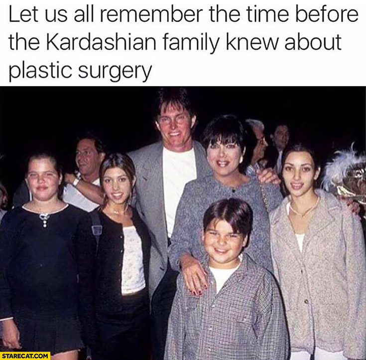Let us all remember the time before the Kardashian family knew about plastic surgery