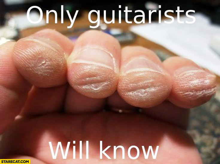 Only guitarists will know finger tips