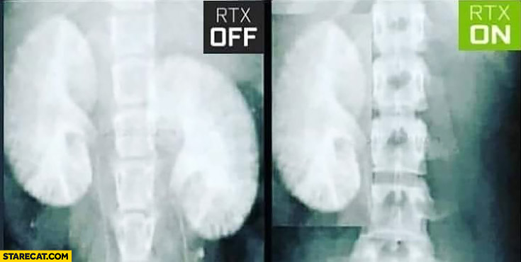 RTX off vs RTX on sold one kidney