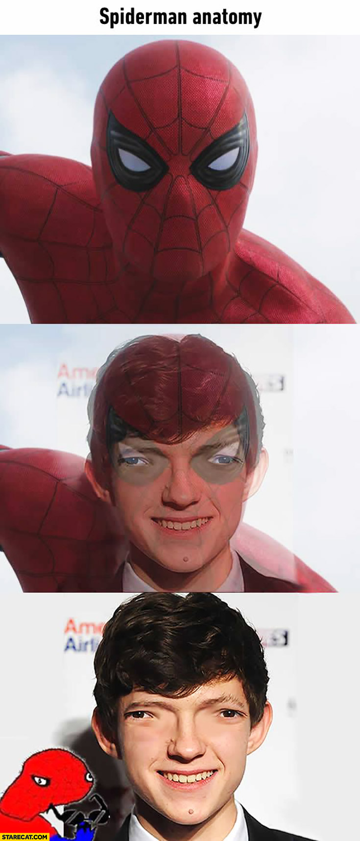 Spiderman anatomy eyes fail