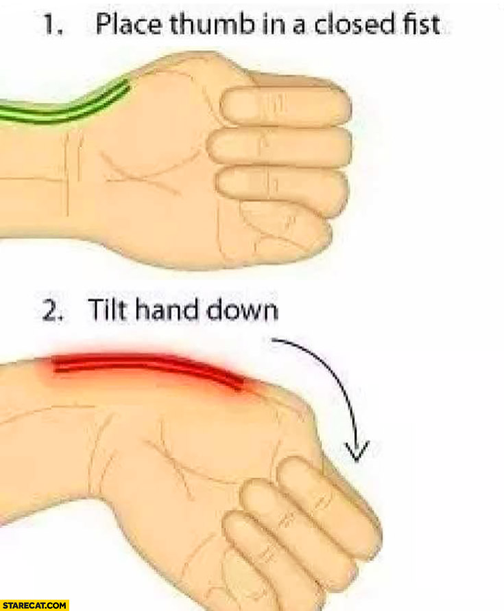 Tendon trick: place thumb in a closed fist, tilt hand down