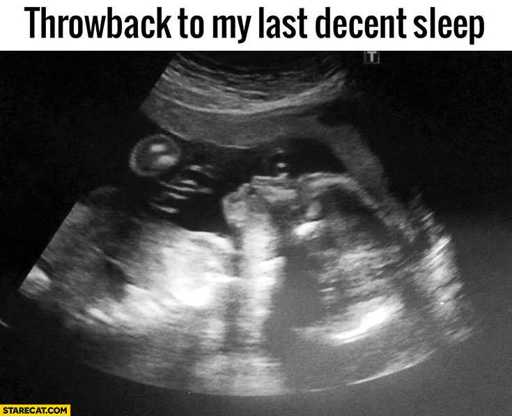 Throwback to my last decent sleep USG ultrasound picture pregnancy