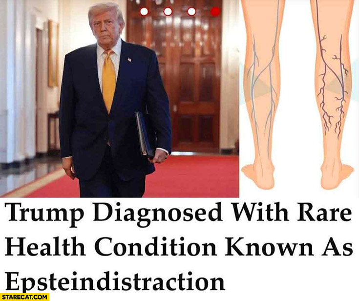 Trump diagnosed with rare health condition known as epsteindistraction