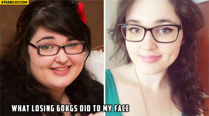 What losing 60 kgs did to my face. Fat woman before and after