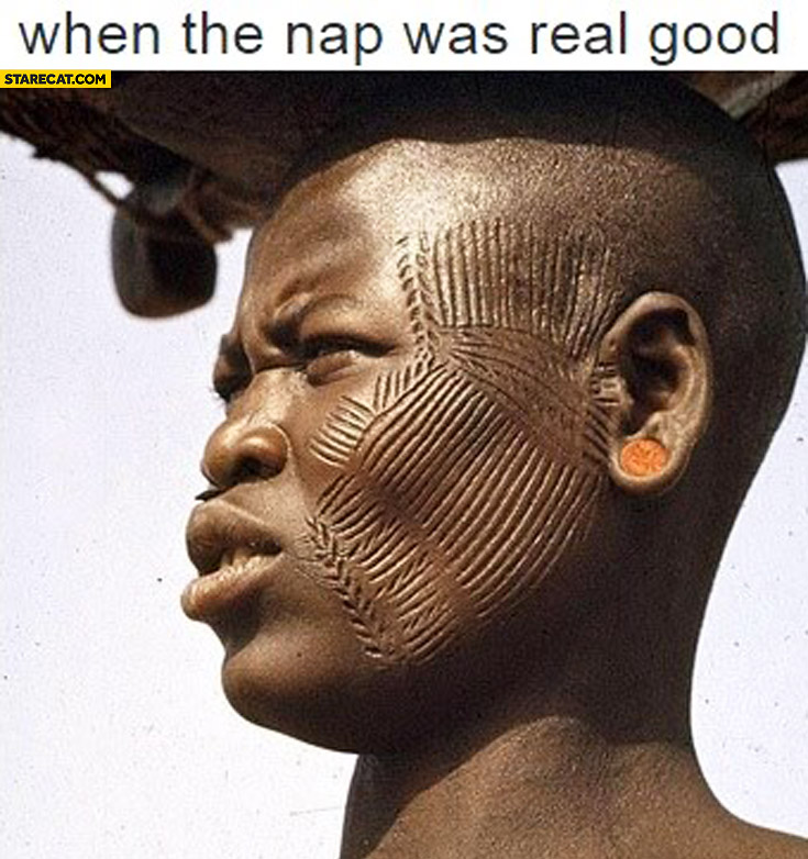When the nap was real good marks on face