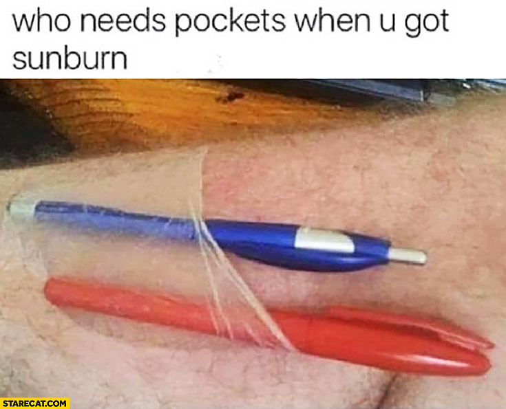 Who needs pockets when you got sunburn?
